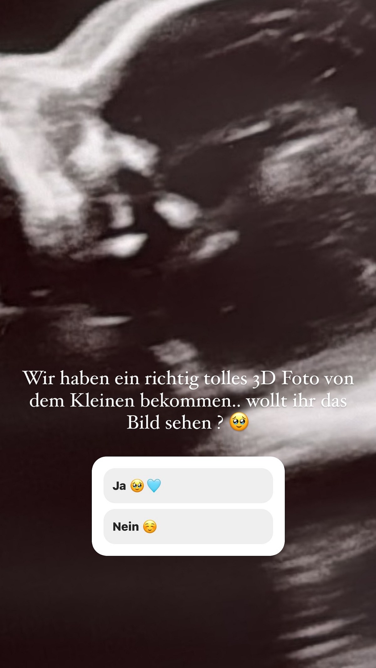 Laura Maria Rypa veröffentlicht erstes Foto von Baby Nummer 2 mit Pietro Lombardi