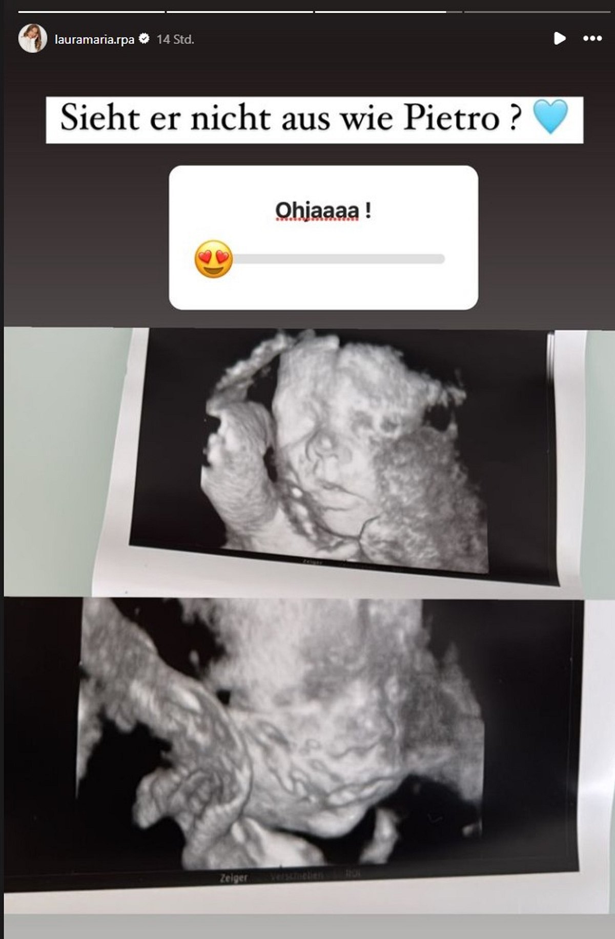 Laura Maria Rypa veröffentlicht erstmals Babyfoto: So sieht der 3. Sohn von Pietro Lombardi aus