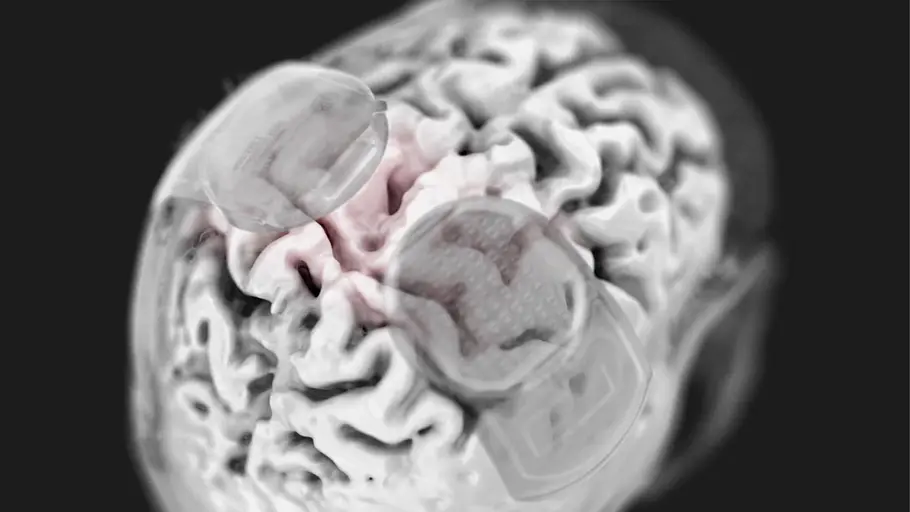 Brain-Computer-Interface: Das digitale Gehirn brain-computer-interface: das digitale gehirn