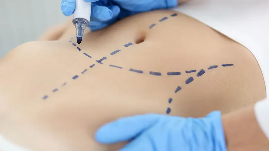 verpfuscht - ein fall für die beauty docs