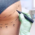 Verpfuscht - Ein Fall für die Beauty Docs Thumbnail
