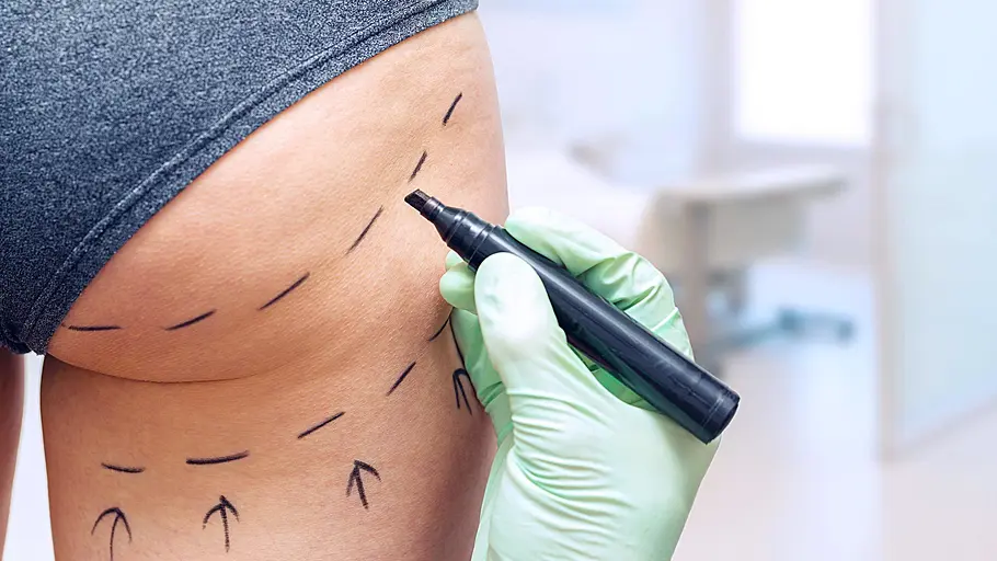 Verpfuscht - Ein Fall für die Beauty Docs verpfuscht - ein fall für die beauty docs