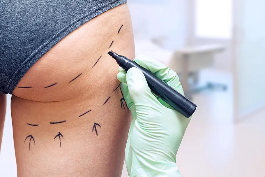 Verpfuscht - Ein Fall für die Beauty Docs verpfuscht - ein fall für die beauty docs