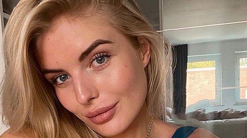 So sieht Antonia Hemmer nicht mehr aus, denn anscheinend hat sie sich die Nase gebrochen! - Foto: Instagram.com/antonia_hemmer/