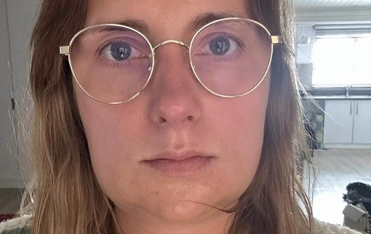 Bauer sucht Frau-Star Anna Heiser vor und nach ihrer Kieferoperation