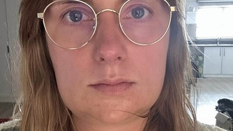 Bauer sucht Frau-Star Anna Heiser vor und nach ihrer Kieferoperation - Foto: Instagram.com/anna_m._heiser/