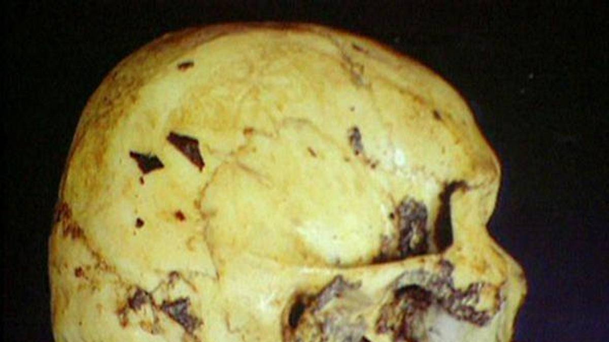 medical detectives - geheimnisse der gerichtsmedizin