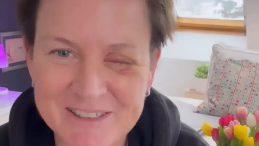 Andrea Plewig Andrea Plewig zeigt ihre Augenverletzung auf Instagram