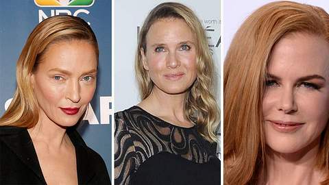 Botox-Wahn: Entstellte Traumfrauen   - Foto: Getty Images