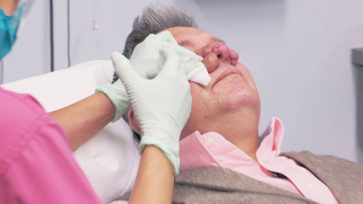 dr. pimple popper
