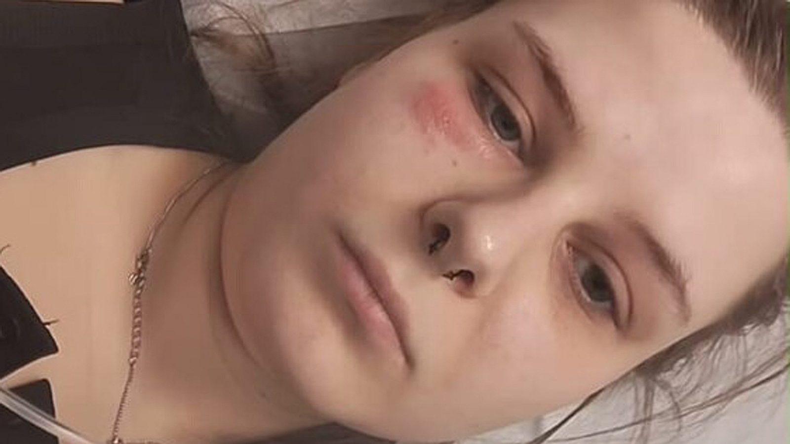 Calantha Wollny krank: Der wahre Grund für ihren Krankenhaus-Aufenthalt