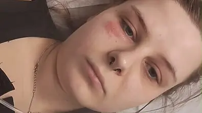 Calantha Wollny ist mit Gürtelrose im Krankenhaus - Foto: Instagram/Randale_caly