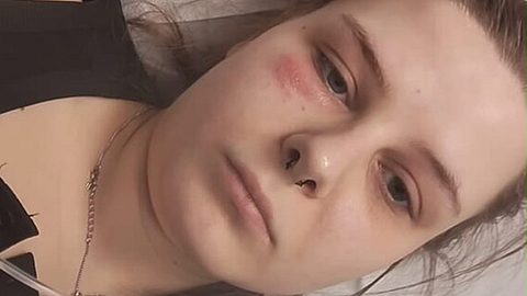 Calantha Wollny ist mit Gürtelrose im Krankenhaus - Foto: Instagram/Randale_caly