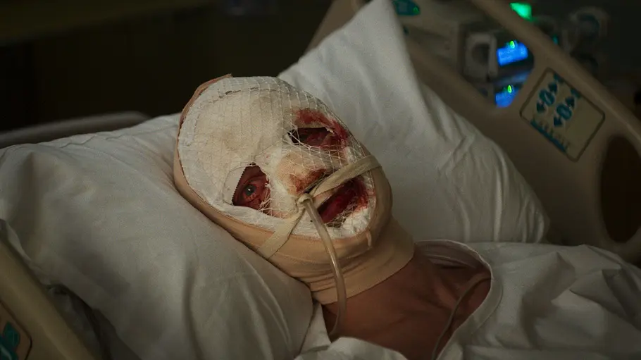 Clayface Matt Hagen aus „Clayface“ liegt mit einem entstellten Gesicht in einem Krankenhaus.