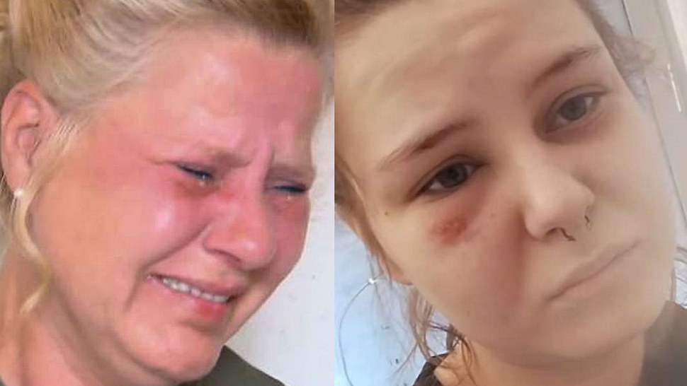 Collage: Silvia Wollny weint bitterlich, Calantha Wollny sieht krank aus, hat unter dem Auge stressbedingte Gürtelrose - Foto: RTL2 und Instagram/Calantha-Wollny