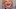 Video Platzhalter Video Platzhalter