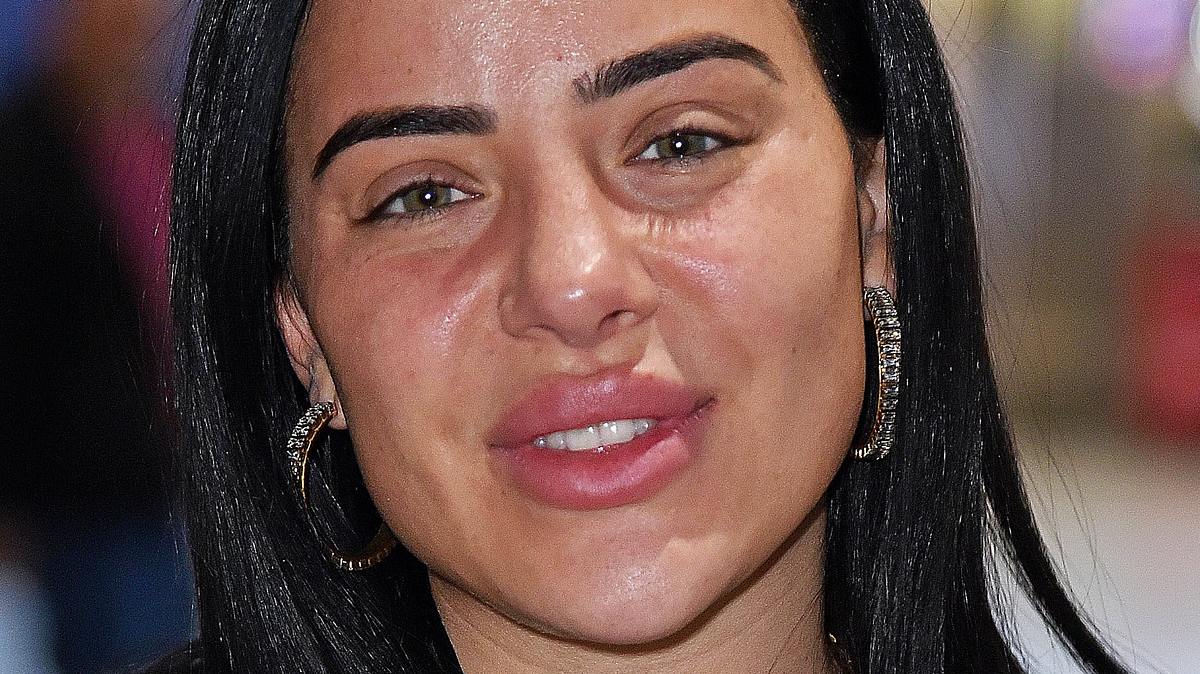 Leyla Lahouar bald ohne dicke Lippen Leyla Lahouar, hier noch mit den vollen Lippen, die ihr Markenzeichen sind, in die Kamera. Jetzt hat sie etwas verändert
