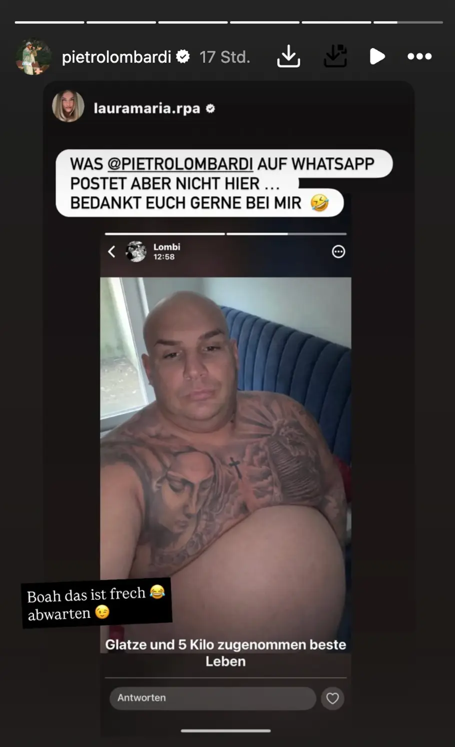 Pietro Lombardi mit Glatze KI Bild, Story-Repost