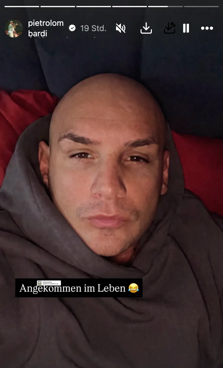 Pietro Lombardi zeigt sich mit Glatze