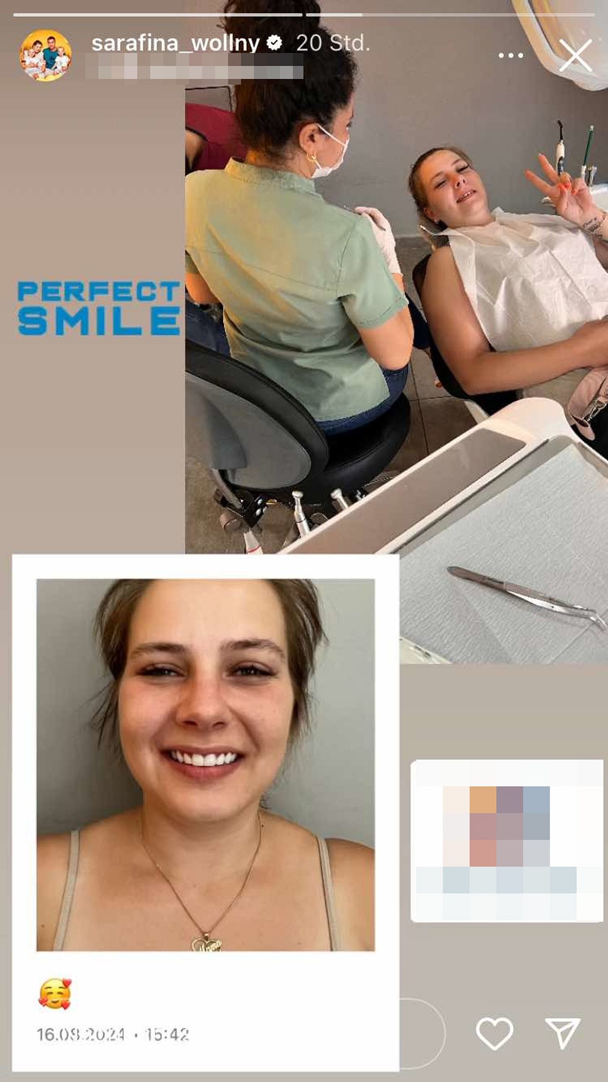 So sieht Sarafina Wollny nach ihrem Beauty-Eingriff mit den neuen Zähnen aus!