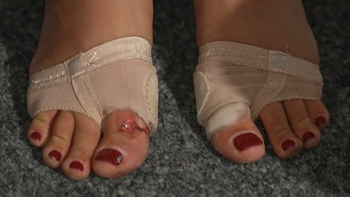 Evelyn Burdecki hat sich beim Training verletzt: An ihrem Fuß klafft eine blutige Wunde